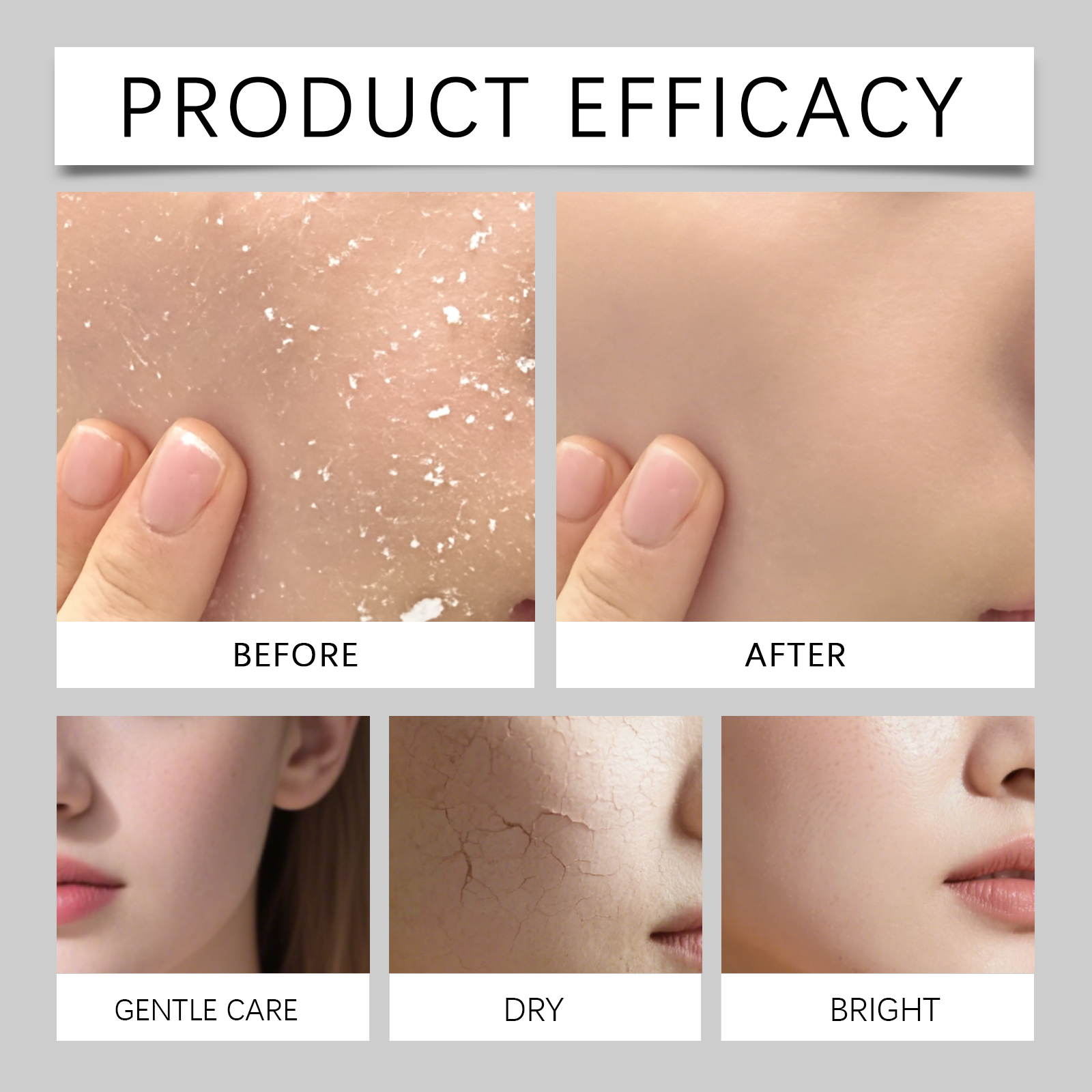 80ml Hydrating Mist for Anti D - Luxury Natural Skincare review and price